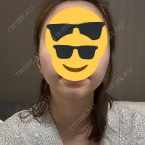 TCB東京中央美容外科 TCB東京中央美容外科 自由が丘院口コミ