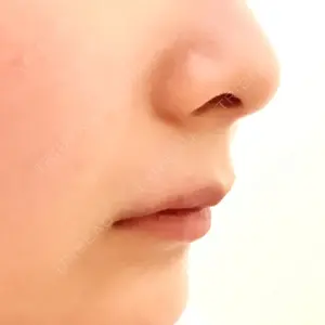 ブルームクリニック（BLOOM CLINIC）口コミ