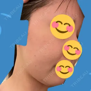 口コミ