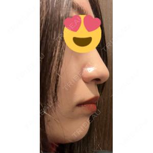 口コミ