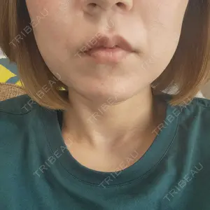 口コミ