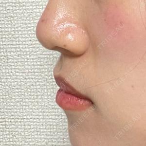 フィラークリニック フィラークリニック 渋谷院口コミ