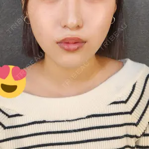 口コミ