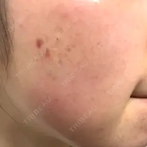 Kinshicho Beauty Clinic （錦糸町ビューティークリニック）口コミ