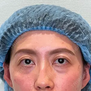 APOLLO BEAUTY CLINIC口コミ