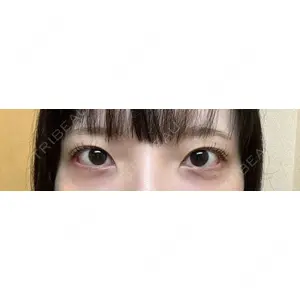 湘南美容クリニック 湘南美容クリニック 池袋東口院口コミ