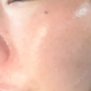 口コミ