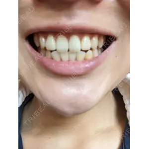 オーラルビューティークリニック クラリス審美歯科・矯正歯科口コミ