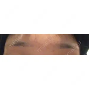 LIFIX BEAUTY CLINIC口コミ