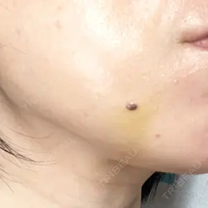 口コミ