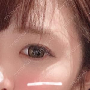 有楽町美容外科クリニック口コミ