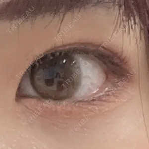 AI Beauty Clinic （エーアイ美容クリニック）口コミ