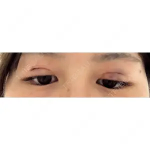 高須クリニック 銀座高須クリニック口コミ