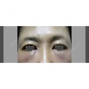 TCB東京中央美容外科 TCB東京中央美容外科 立川院口コミ