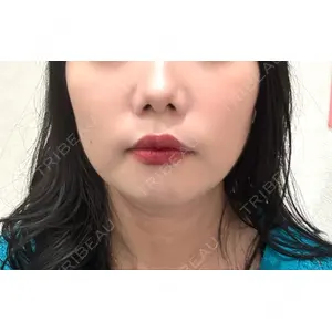口コミ