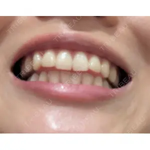 オーラルビューティークリニック クラリス審美歯科・矯正歯科口コミ