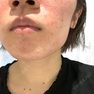 Tokyo Tensei Clinic Tokyo Tensei Clinic 銀座院口コミ