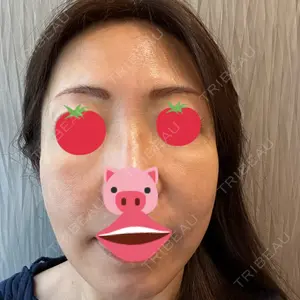口コミ