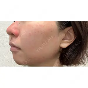 JBCジュノビューティークリニック 新宿三丁目院口コミ