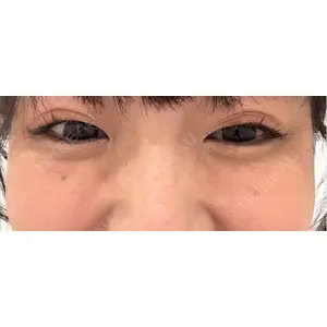 口コミ