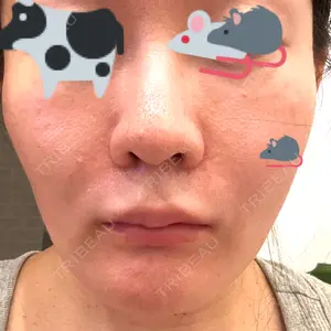 ミニマムスキンクリニック ミニマムスキンクリニック池袋口コミ