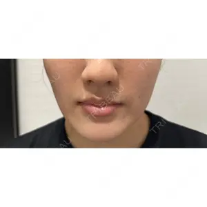 R Beauty CLINIC 名古屋院口コミ
