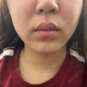 Tokyo Tensei Clinic Tokyo Tensei Clinic 銀座院口コミ
