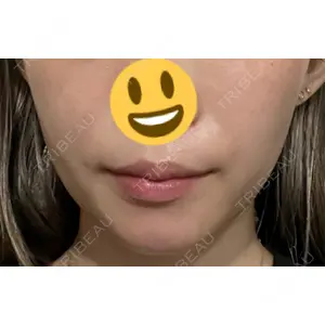口コミ