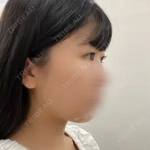 フィラークリニック フィラークリニック 大阪心斎橋院口コミ