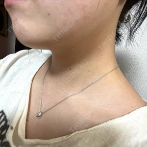 MIL CLINIC OSAKA口コミ