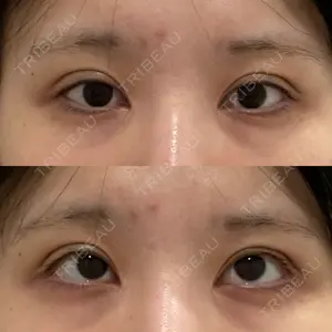 湯田クリニック 銀座口コミ