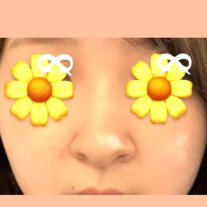 LUHO（ルホ）美容外科口コミ