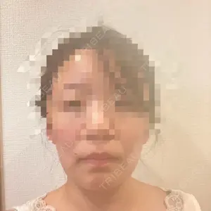 DMTC美容皮膚科 DMTC美容皮膚科 日本橋院口コミ