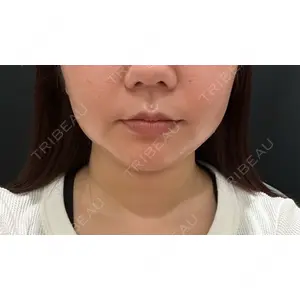 湯田クリニック 銀座口コミ