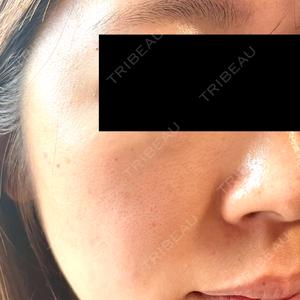 B-LINE CLINIC B-LINE CLINIC 池袋院口コミ