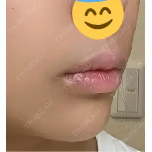 口コミ