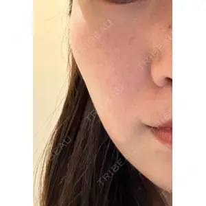 Re:anne clinic 銀座 【リアンクリニック銀座】口コミ