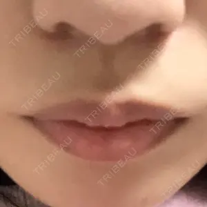 口コミ