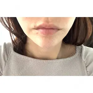 口コミ
