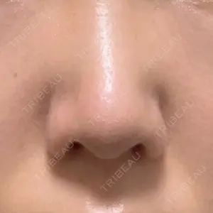 GLANZ CLINIC口コミ