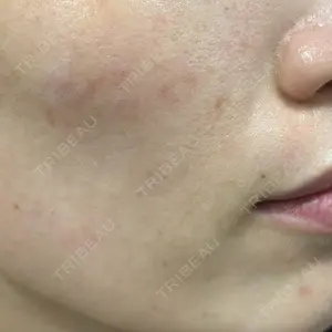 Kinshicho Beauty Clinic （錦糸町ビューティークリニック）口コミ
