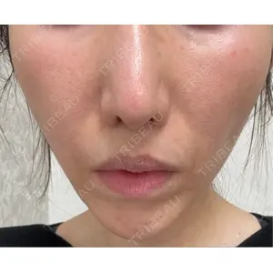 ミモザ美容クリニック口コミ