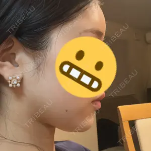 セギム美容整形外科口コミ