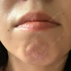 BON BON CLINIC BON BON CLINIC 銀座駅前本院口コミ