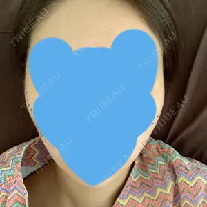 View美容整形外科口コミ