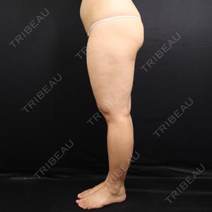 藤・ナチュレ美容クリニック 藤・ナチュレ美容クリニック 銀座院口コミ