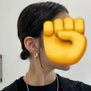 TCB東京中央美容外科 TCB東京中央美容外科 小倉院口コミ