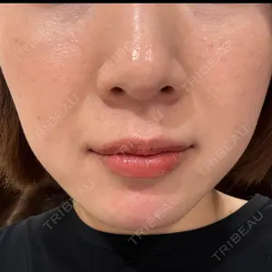 Rinato Beauty Clinic口コミ