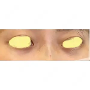 渋谷美容外科クリニック 渋谷美容外科クリニック 横浜院口コミ