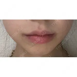 B-LINE CLINIC B-LINE CLINIC 大阪院口コミ